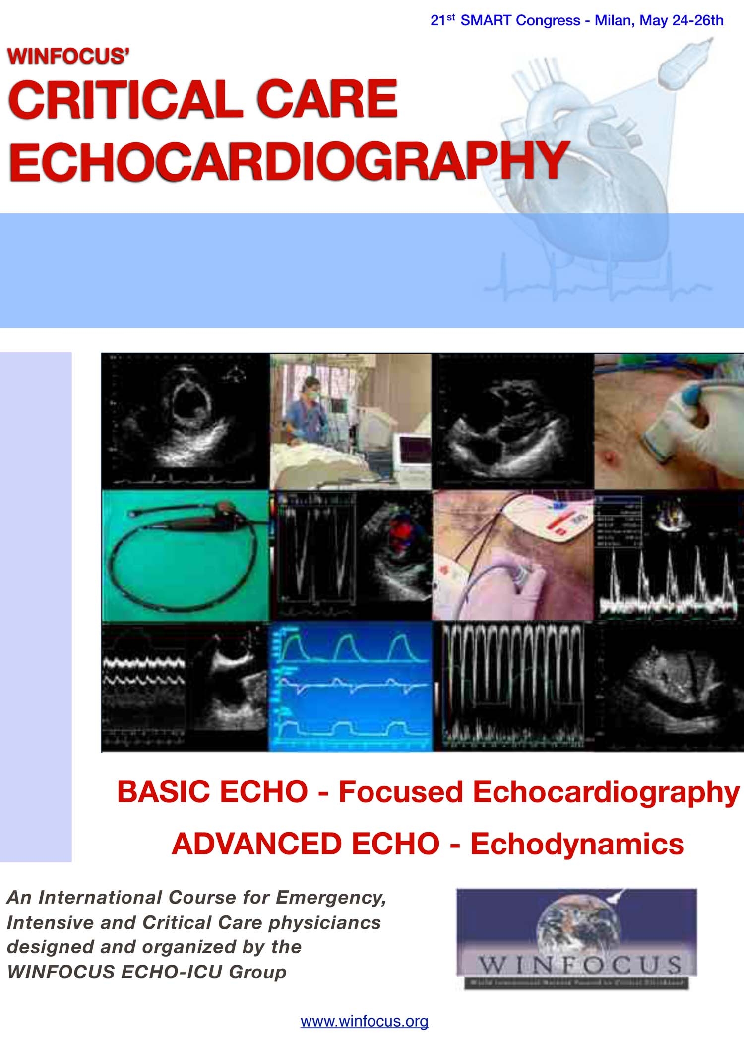 Critical Care Echocardiography